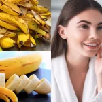 <strong>Health Benefits Of Banana Peels-Surprising Facts</strong>